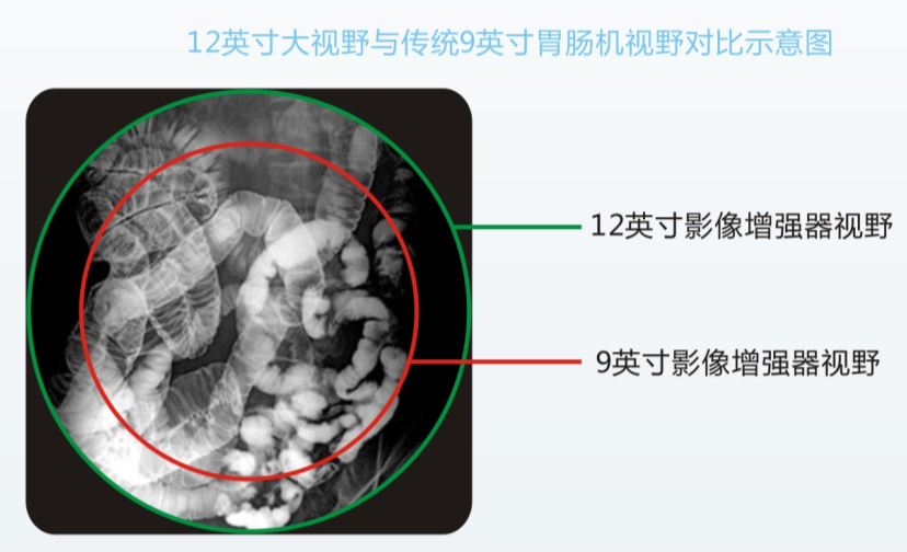 數字化平板胃腸機PLD8600B